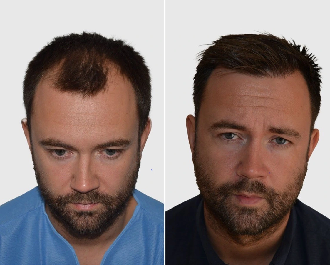 Ηair Clinic Καλαμάτα