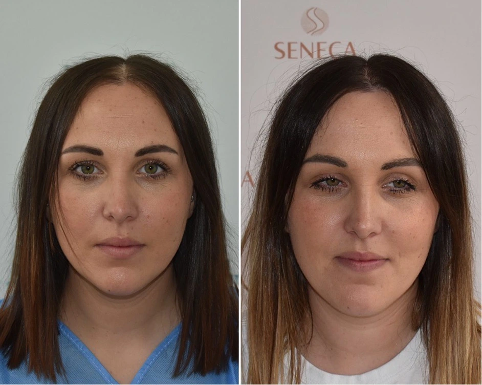 Ηair Clinic Καλαμάτα