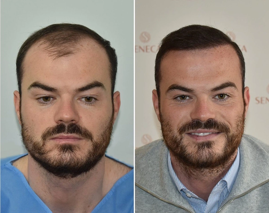 Ηair Clinic Καλαμάτα