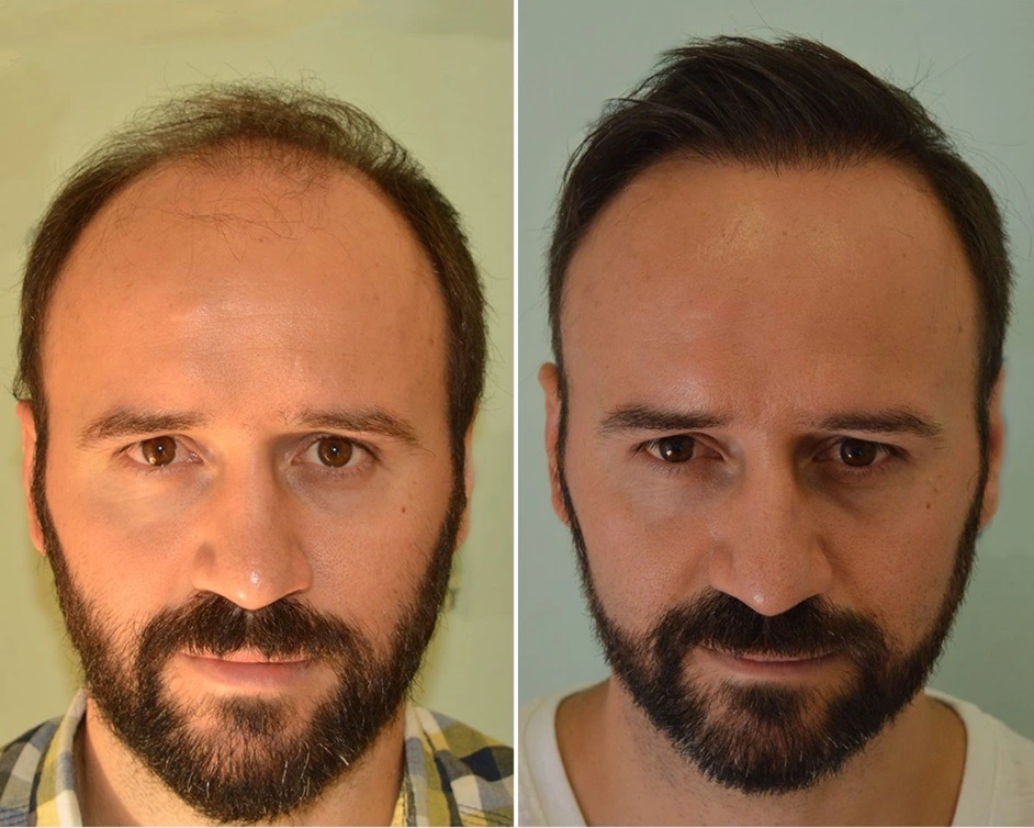 Ηair Clinic Καλαμάτα